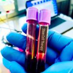 university-of-hyderabad-incubated-startup-publicizes-profitable-animal-trials-of-stem-cell-remedy-for-liver-failure