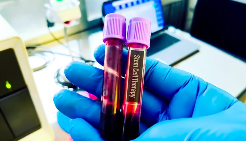 university-of-hyderabad-incubated-startup-publicizes-profitable-animal-trials-of-stem-cell-remedy-for-liver-failure