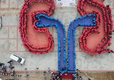 kidney-on-the-market