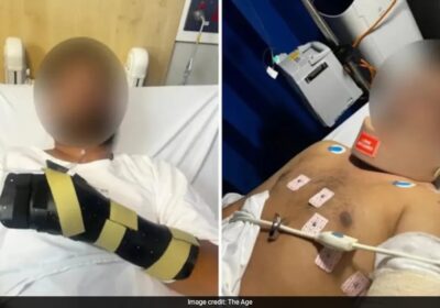Hand Hanging By A Thread': Indian-Origin Man Attacked With Machete ...