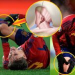 Pablo Gavi Complete Tear of ACL Will Sideline Him For More Than 7 Months